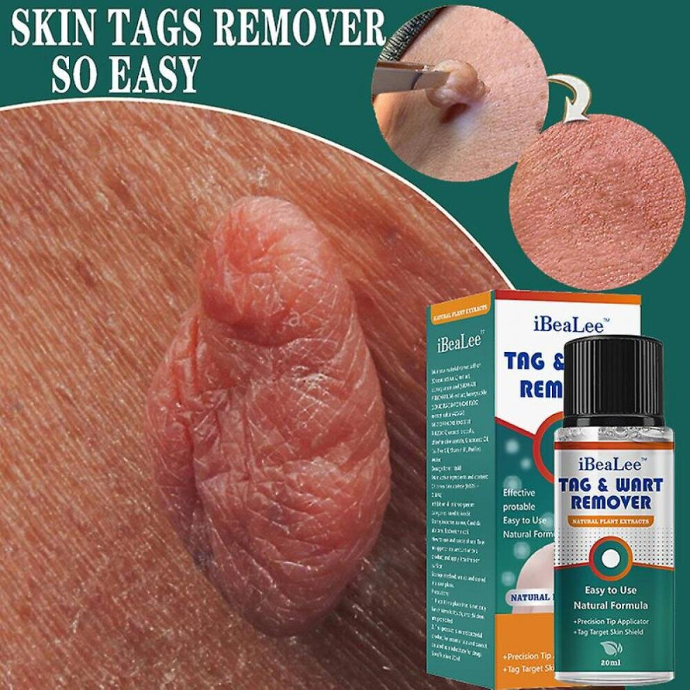 Hkhbjs Cream Skin Tags Remover Mole Skin Warts Remover Serum Face Wart Tag Removal Oil