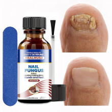 Rep Serum Anti- L Anti Paronya Onychocosis Paronya Feet Care