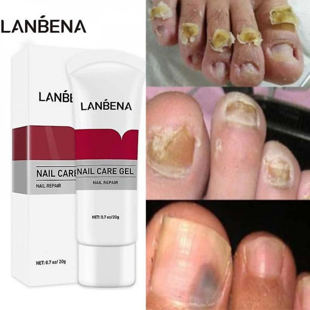 S L Foot Fungus Remover Cuticle Oil Rep Ing Anti Y Care Product