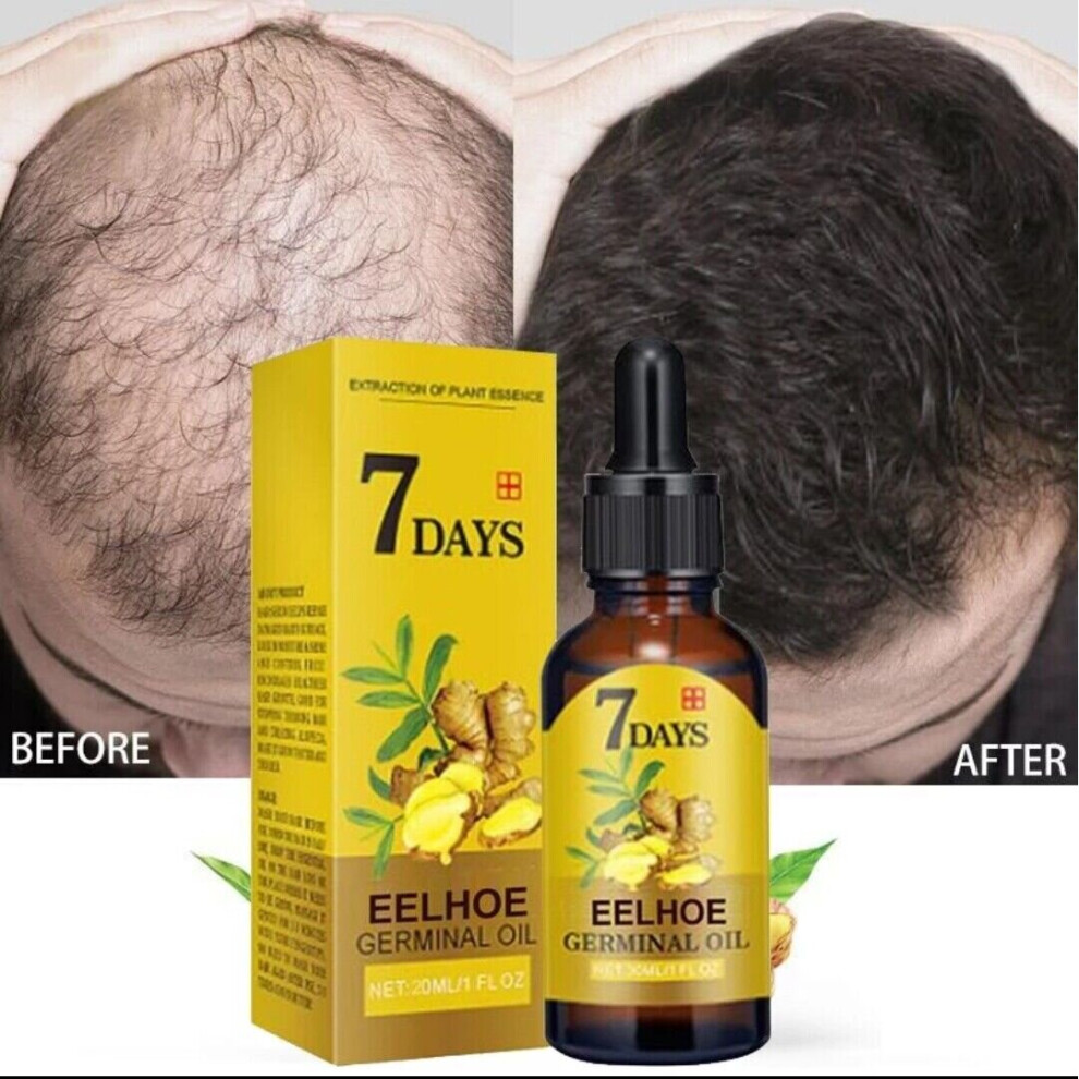 Yetp Star (10Ml) Hair Regrowth Serum Natural Hair Growth Treatment - With Ginger Essential Oil