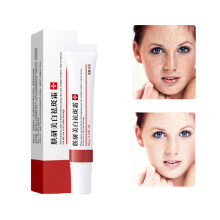 Whitening Freckle Cream Remove Melasma Cream Remove Dark Spots Melanin