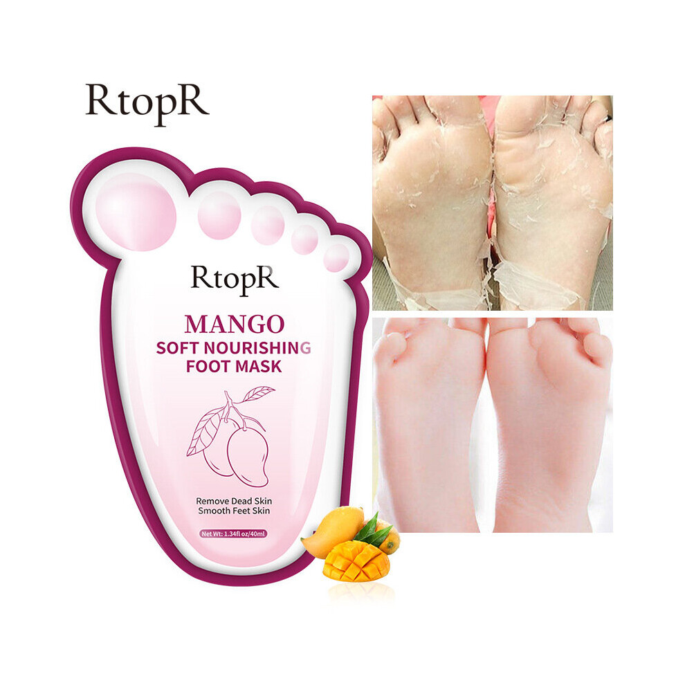 Yetp Star Cream Rtopr Peeling Foot Mask Exfoliating Dead Skin Improve Dry Cracked Foot Skin Repair Whitening Pedicure