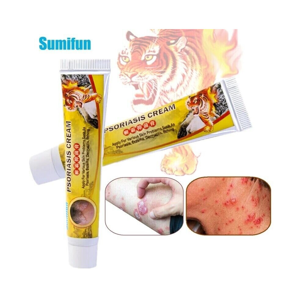 Skesrjtop Cream Body Psoriasis All Body Skin Care Bacteriostasis Dermatitis