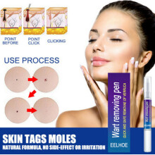 2PCS 12 Hours Wart Remover Pen Skin Tag Mole Remover UK STOCK