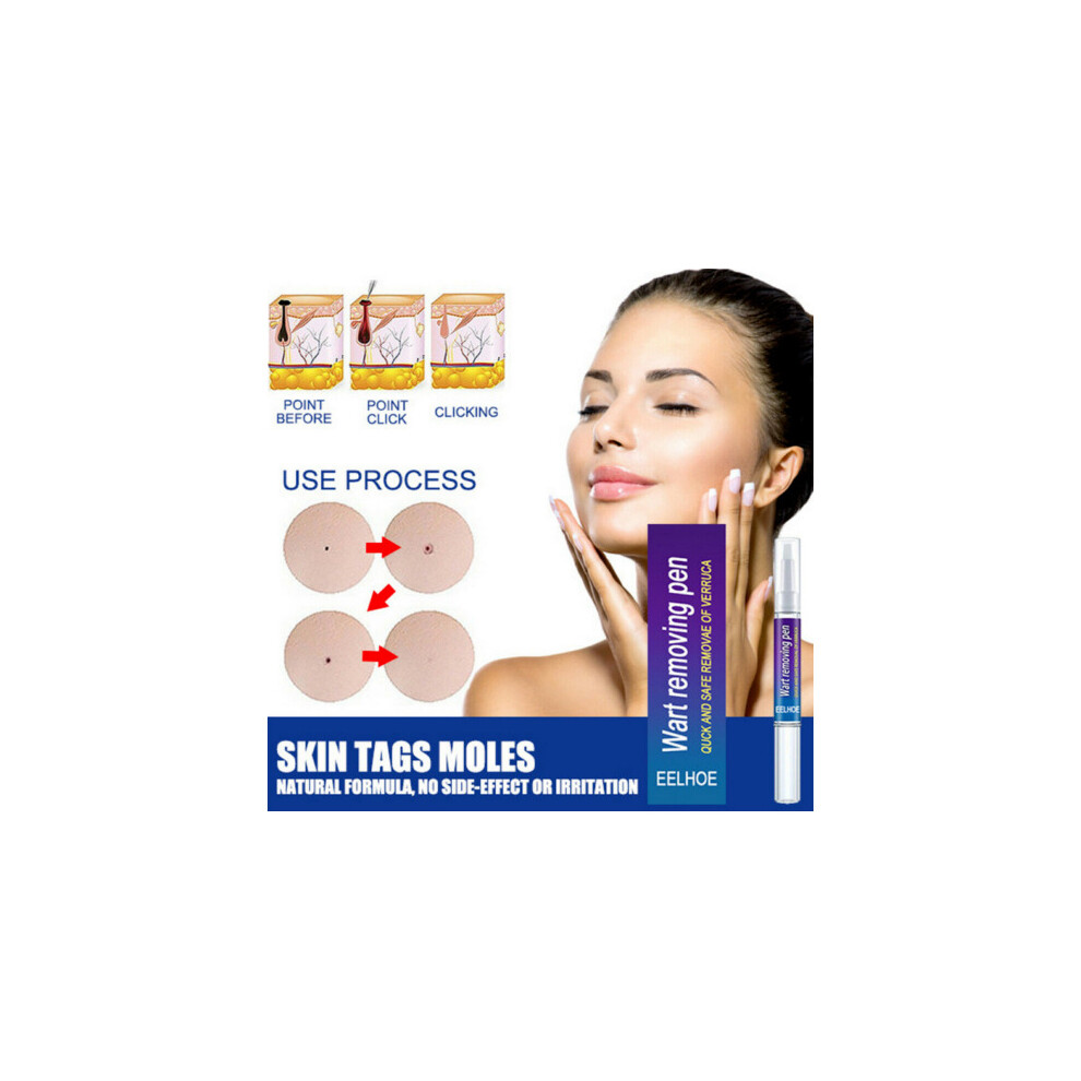 Skesrjtop 2Pcs 12 Hours Wart Remover Pen Skin Tag Mole Remover Uk Stock