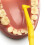 Tepe TePe Angle Interdental Brush, Yellow 0.7mm (6 Pieces/Packet) 3
