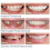 On False Teeth Upper + Lower Dental Veneers Dentures Tooth Cover Set 3