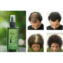 (1 Month Supply) Neo Hair Lotion Natural Treatment For Hair Loss/Regrowth For Men & Women 120ml
