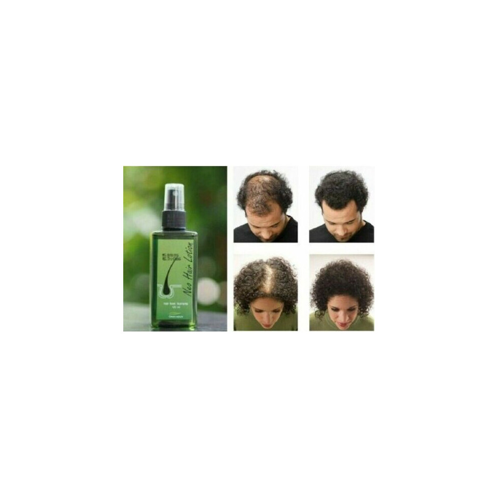 (1 Month Supply) Neo Hair Lotion Natural Treatment For Hair Loss/Regrowth For Men & Women 120ml
