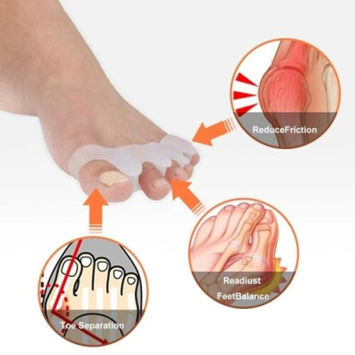 2pcs Hallux Valgus Toe Spreader Separates Toes Support Toe Separator 2