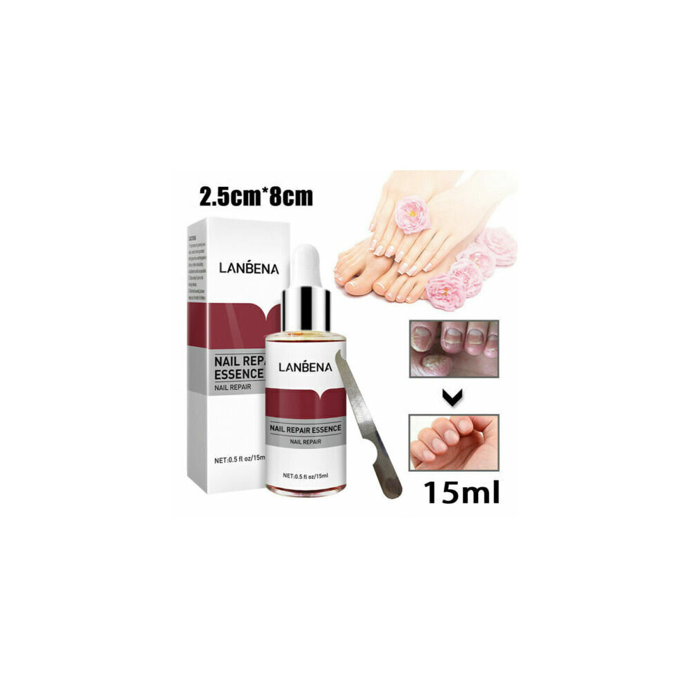 Skesrjtop Repair Essence Remove Onychomycosis Serum Fungal Treatment & File
