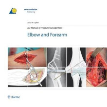 AO Manual of Fracture Management Elbow Forearm AOPublishing