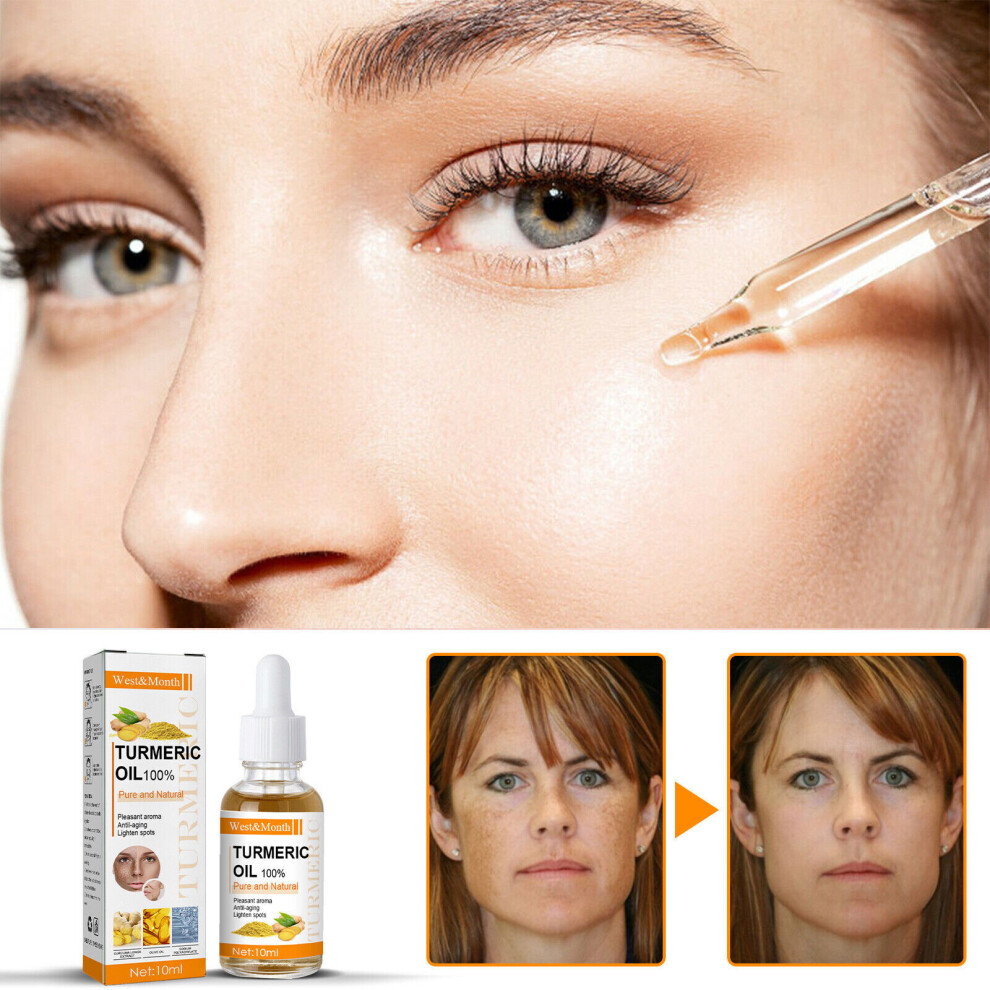 Yetp Star Skinetic Spot-Off Turmeric Oil, Turmeric Dark Spot Corrector Serum