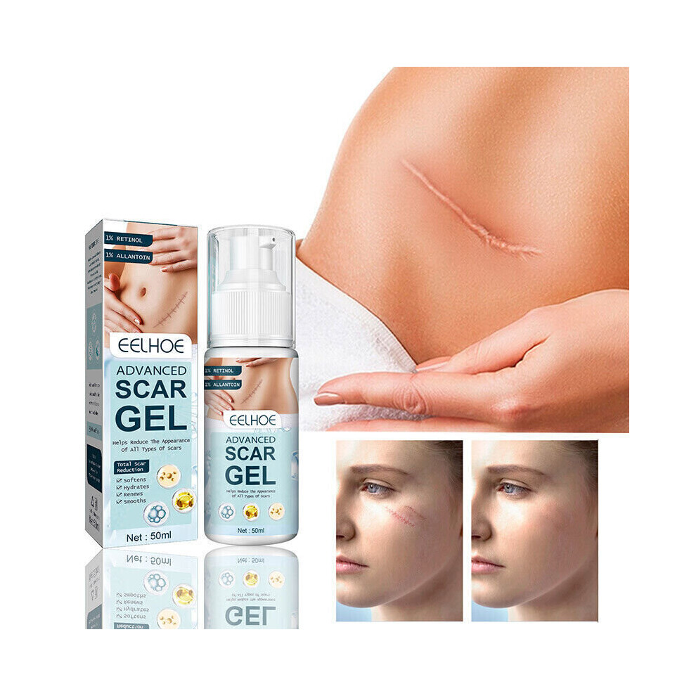 Yetp Star 50Ml Advanced Scar Gel For Acne Stretch Marks Removal Surgical Scar Treatment
