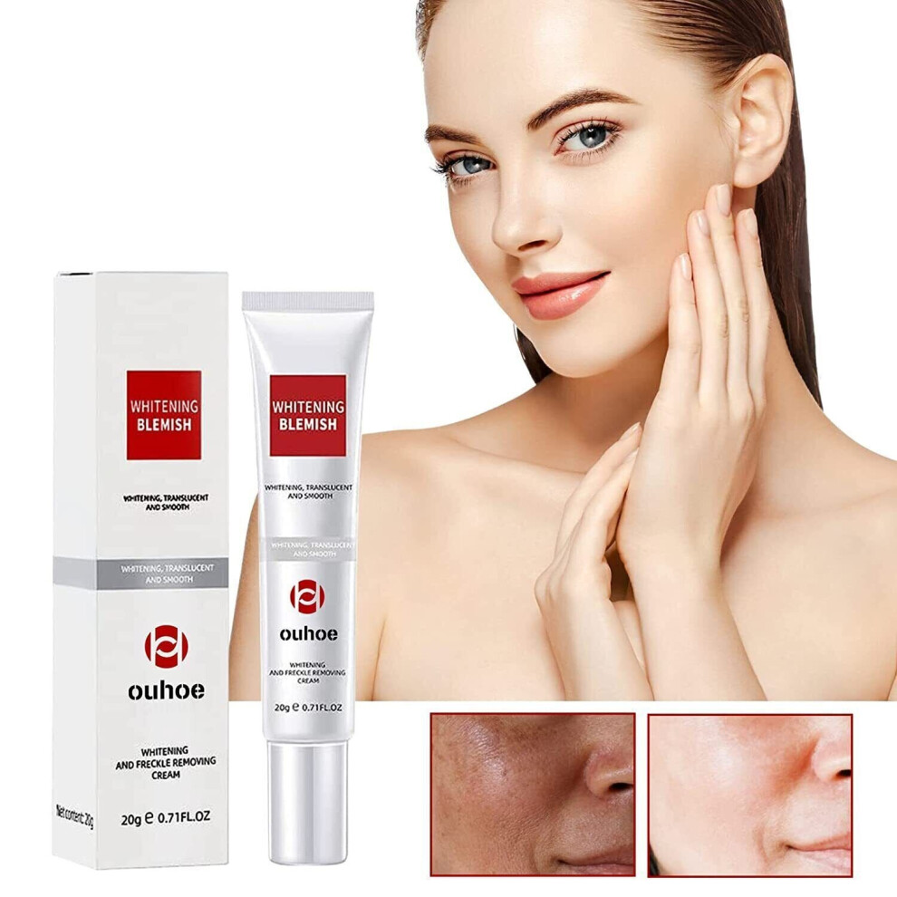 Blemish Removal Cream,Whitening and Freckle Removing Cream