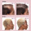 Viviscal Densifying Shampoo And Conditioner 8.45 Oz Set 9