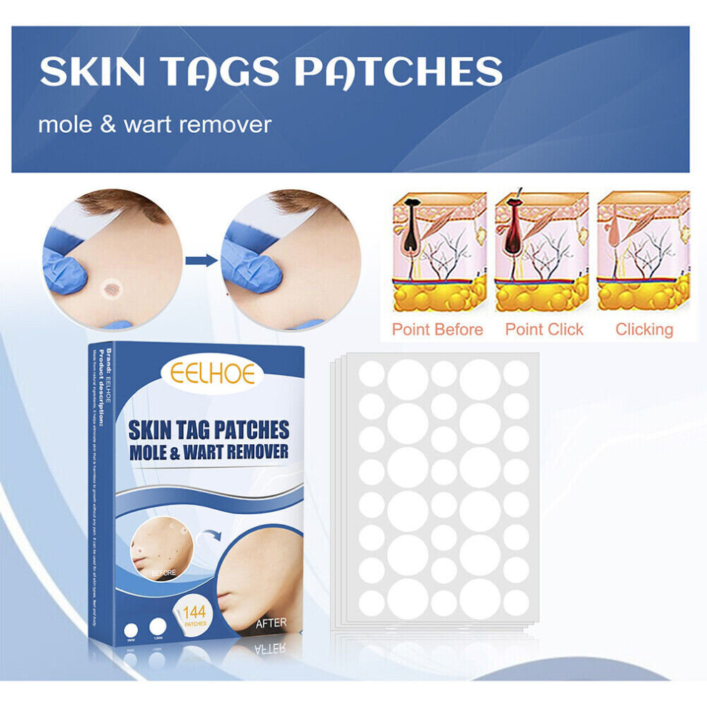 Xylfly 144Pcs Skin Tags Wart Remover Patch Acne Pimple Patches Plaster