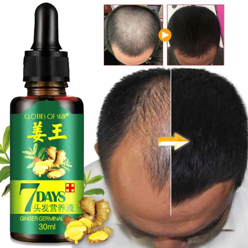 Hair Growth Essential Oil Loss Natural Ginger Ginseng Regrowth Serum Hair Essence