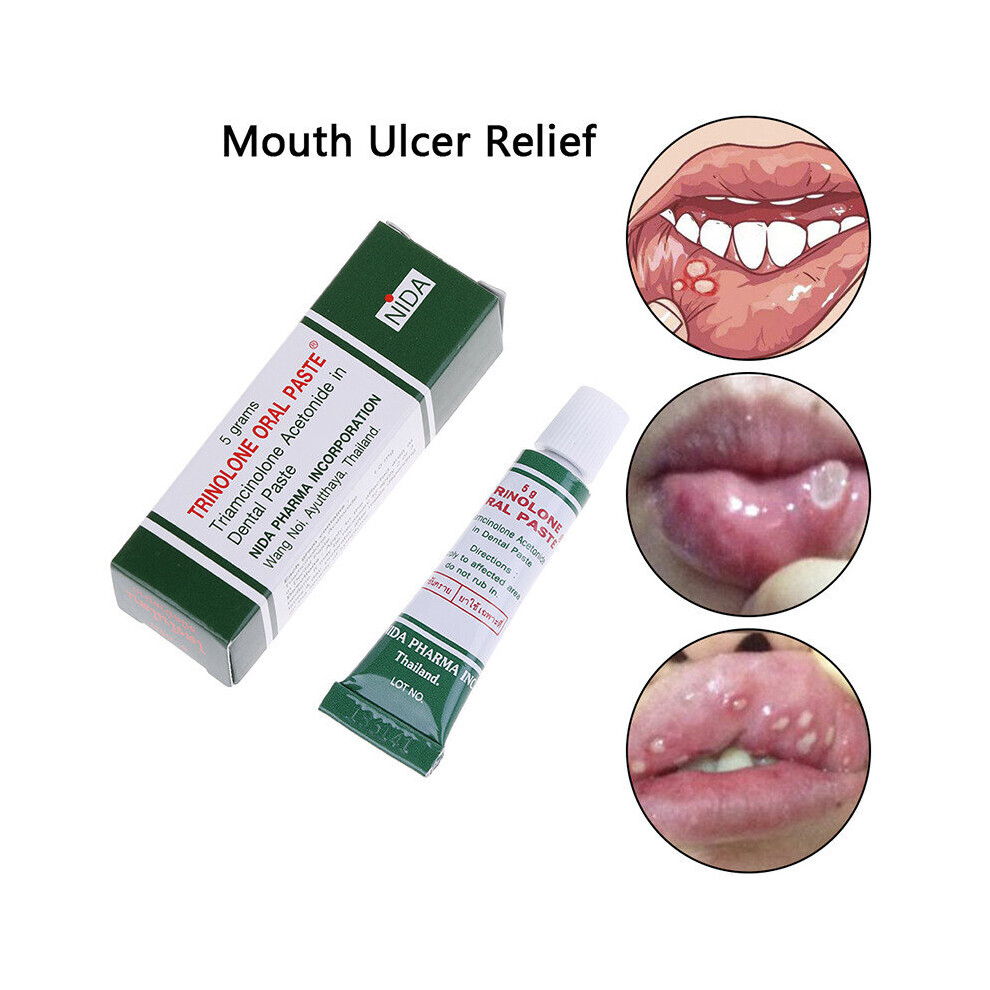 (1pc) ORAL ULCER OINTMENT NIDA TRINOLONE ORAL PASTE 5g