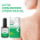Active Corn Remover Strengthen Gel Foot BEST 5