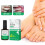 Active Corn Remover Strengthen Gel Foot BEST 4