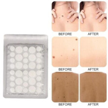 NEW SKIN TAG REMOVER PATCHES NATURAL TREATMENT MOLES WARTS SAFE