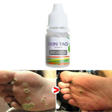Chinese Medicine Treatment Skin Warts Removal Foot Corn Removal Plantar warts Pomada De Verruga Skin Care Medical Ointment