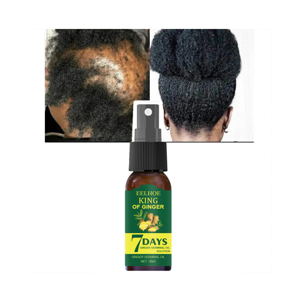 Wejoy 30Ml Hair Growth Essence Germinal Serum Essence Oil Natural Loss Treatement Effective Fast Growth Scalp Treatment Men Women