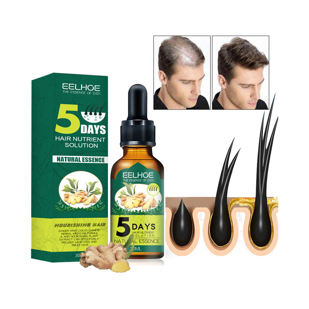 Wejoy 5 Days Ginger Hair Growth Essential Oil Products Anti Hair Loss Serum Fast Growing Nourish Soften Scalp Repair Damaged Hair Care