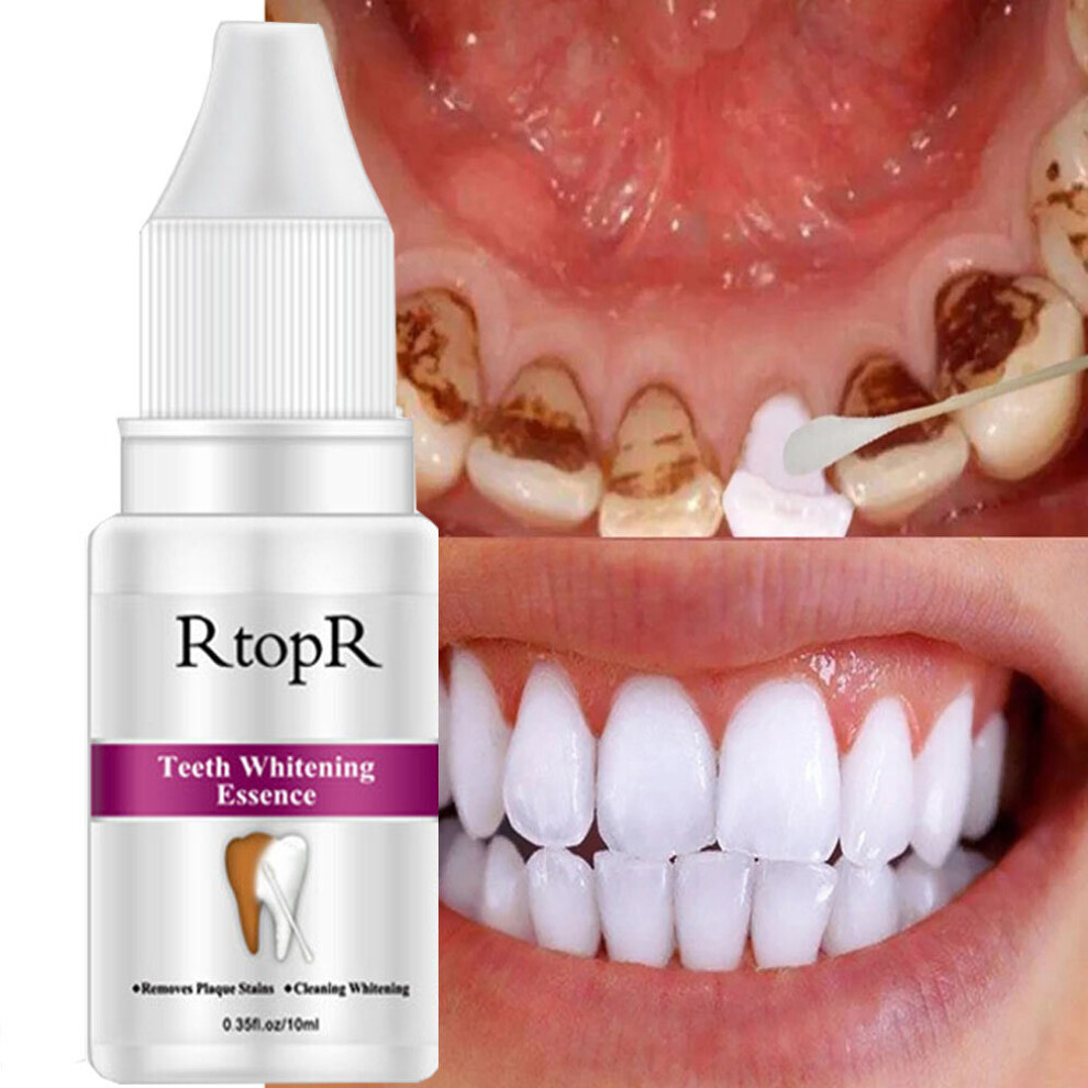 Wejoy Yellow Teeth Whitening Essence Stains Teeth Treatment Smoke Coffee Plaque Dental Oral Hygiene Remove Whitening Tooth Care