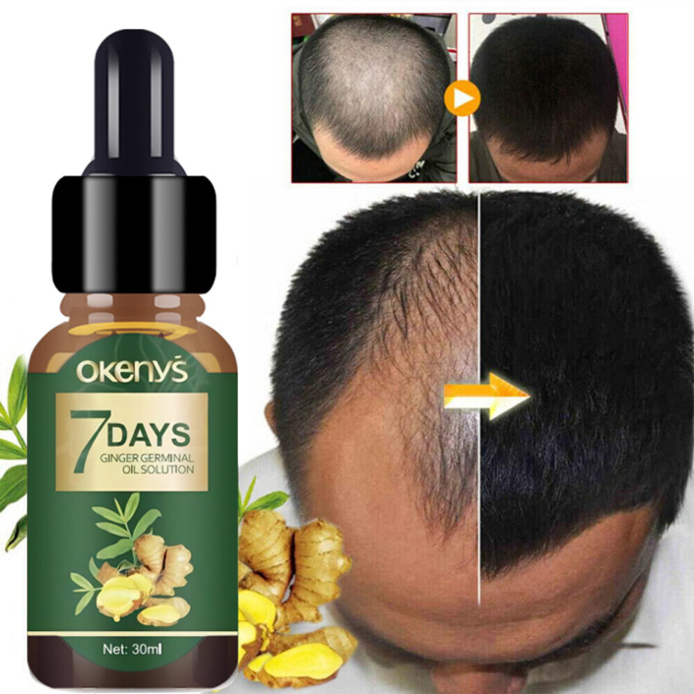 Wejoy Ginger Hair Growth Essence 7 Days Germinal Hair Growth Serum Essence Oil Hair Loss Treatment Growth Hair For Men Women