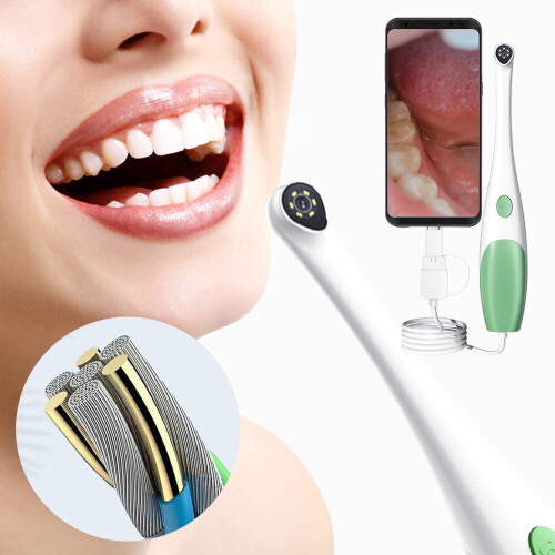 Portable HD Oral Camera 640x408P 6 LED 3 In 1 Interface Pet Oral Dental Mirror