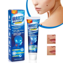 60g Warts Remover Ointment Wart Treatment Antibacterial Cream Skin Tag Removal Herbal Plaster Relief Corn Wart Oil Care