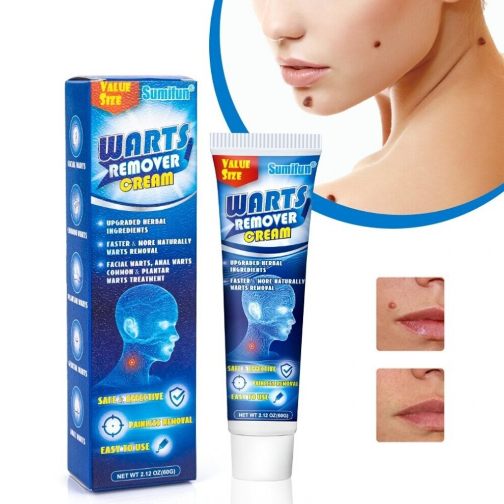 Wejoy Cream 60G Warts Remover Ointment Wart Treatment Antibacterial Skin Tag Removal Herbal Plaster Relief Corn Wart Oil Care