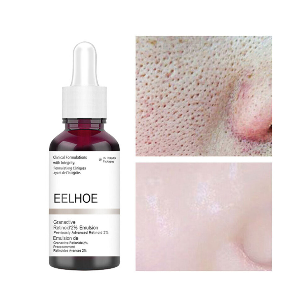 Salicylic Acid Shrink Pores Serum Fruit Acid Exfoliating Moisturizing Nourish Smooth Pores Repair Essence Products Skin Care