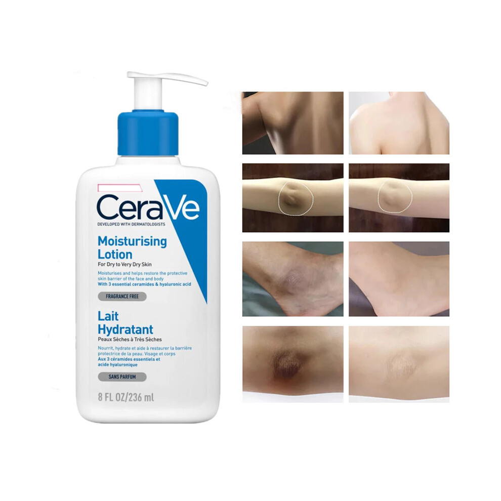 CeraVe Whitening Cream Moisturizing Nourish Repair Improve Arm Armpit Ankles Elbow Knee Body Dull Brighten Arbutin Skin Care 236