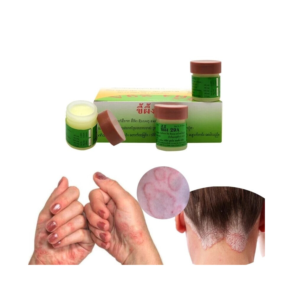 Wejoy Cream Thailand 29A Natural Ointment Psoriasis Eczema For Dermatitis Eczema Urticaria Traditional Skin Medical Plaster Care