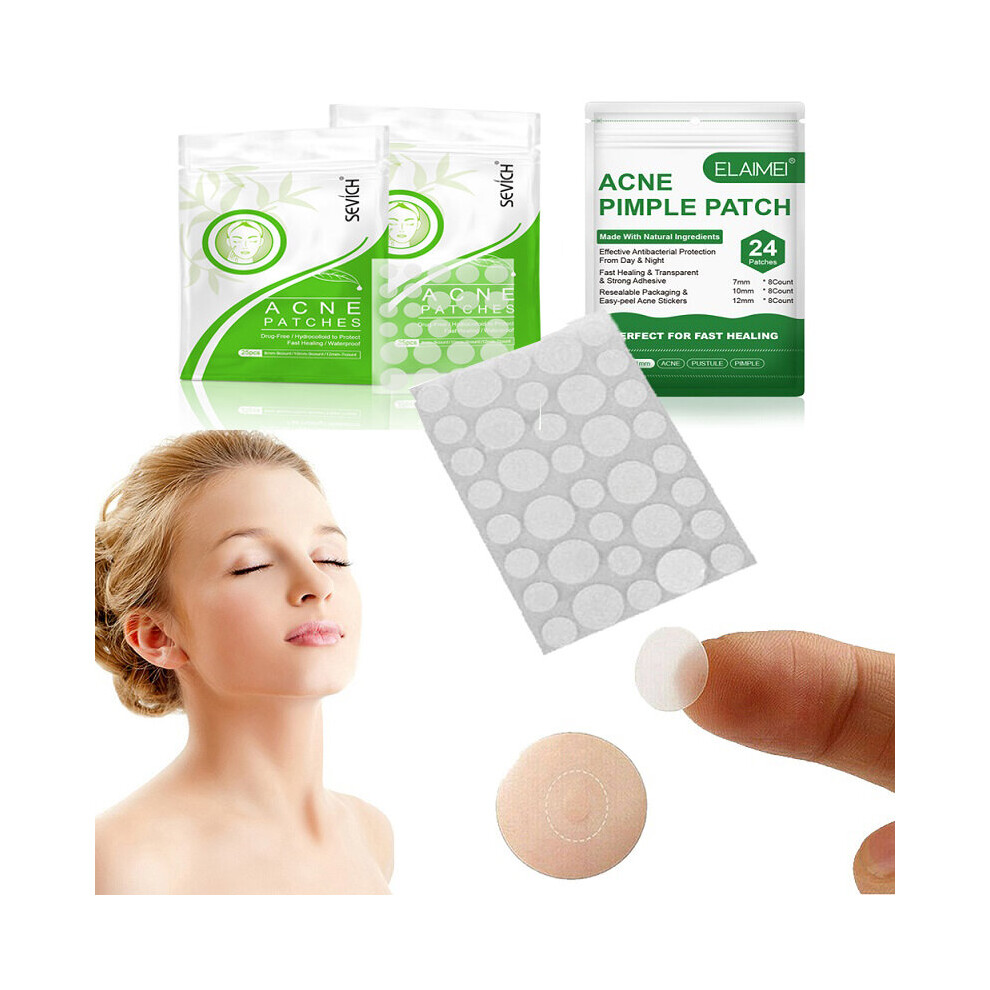 Wejoy 36 Patches Beauty Acne Tools Hydrocolloid Acne Patch Set Skin Tag Remover Pimple Master Hydrocolloid Patch Face Skin Care Tslm1