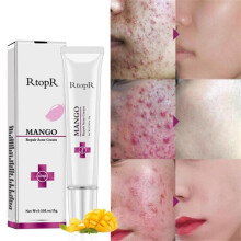 RtopR Mango Repair Acne Cream Whitening Moisturizing Face Cream Anti-acne Treatment Shrinks Pore Day Creams Skin Care TSLM2