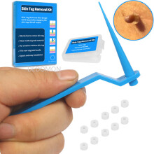 Blue Set Skin Tag Removal Kit Home Use Mole Wart Remover Equipment Micro Skin Tag Treatment Tool Easy To Clean Skin Care Tool
