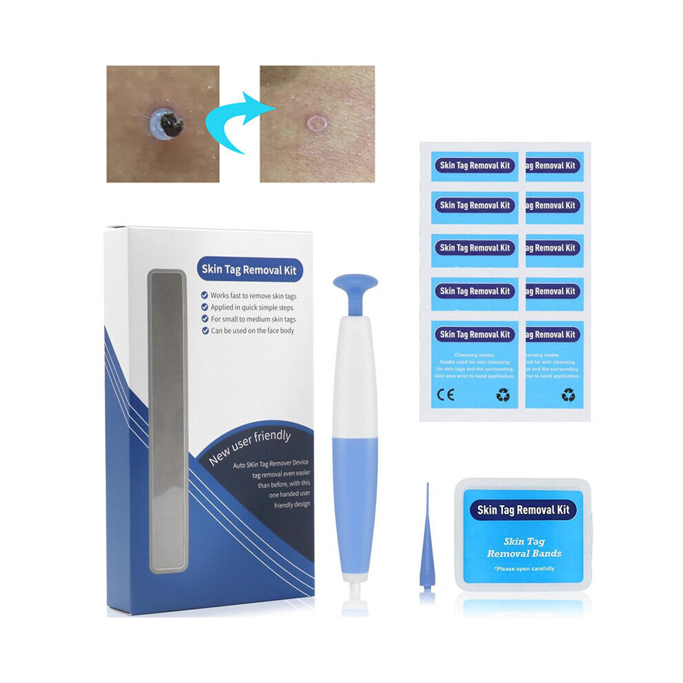 Wejoy 1 Set Skin Tag Remover To Remover Wart Spot Remover Mole Remover Skin Care Effect Band