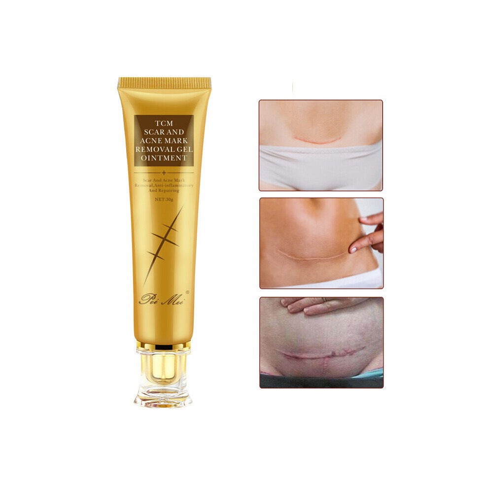 Wejoy Removal Scar Cream Face Pimples Scar Stretch Marks Removal Acne Treatment Whitening Moisturizing Cream Skin Care