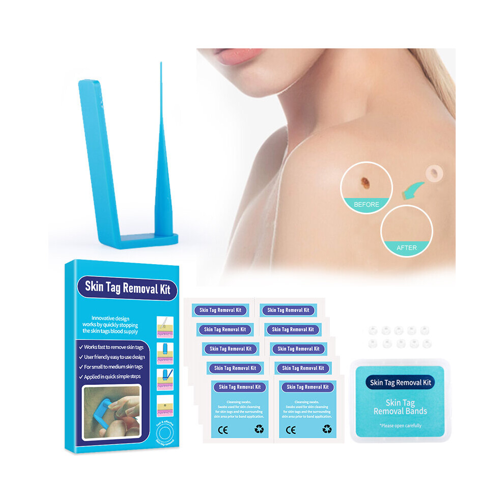 Wejoy Skin Tag Removal Kit Mini Micro Skin Tag Treatment Tool Skin Facial Care Mole Wart Remover With Cleaning Swabs Easy To Clean