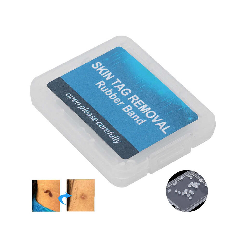 Wejoy 30Pcs Skin Tag Removal Rubber Bands Micro Band Non Toxic Face Care Mole Wart Skin Care Tools