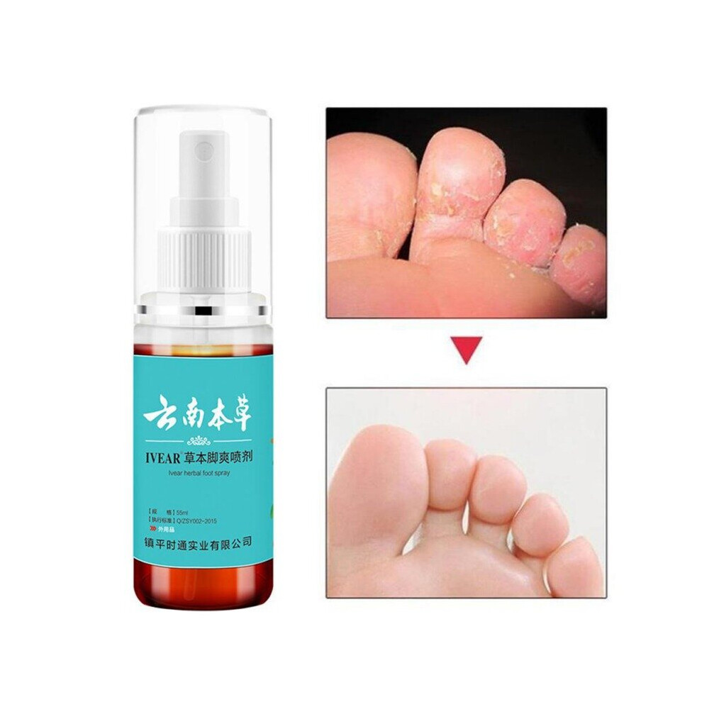 Wejoy 55Ml Herbal Beriberi Remove Foot Liquid Spray Anti-Fungal Antibacterial Deodorant Anti Itchy Sweat Odor Health Feet Skin Care