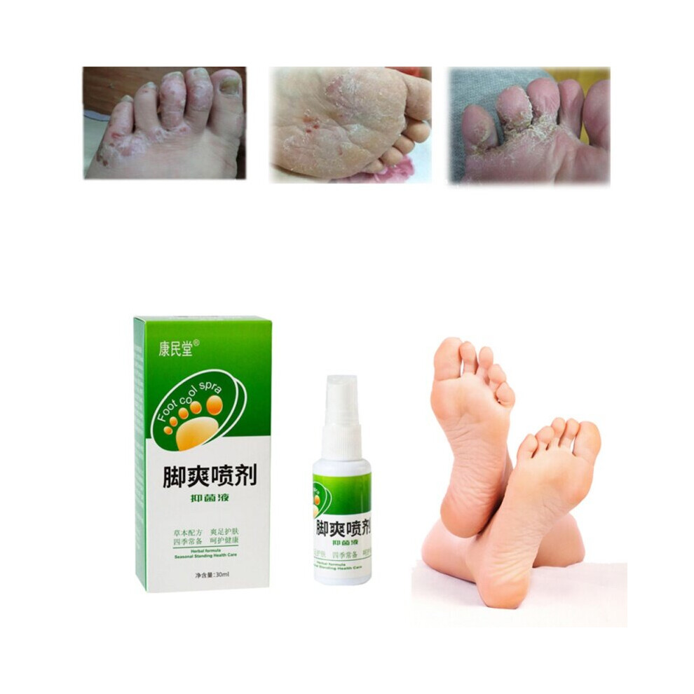 Wejoy 30Ml Plant Spray Feet Care Remove Odor Sweat Feet Treatment Wholesale Natural Practical Foot Care Products
