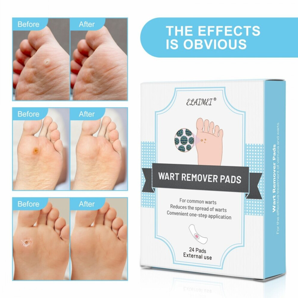 Wejoy 24Pcs/Box Foot Corn Plaster Pads Patches Plaster Foot Corn Removal Remover Warts Thorn Callus Corn Foot Care