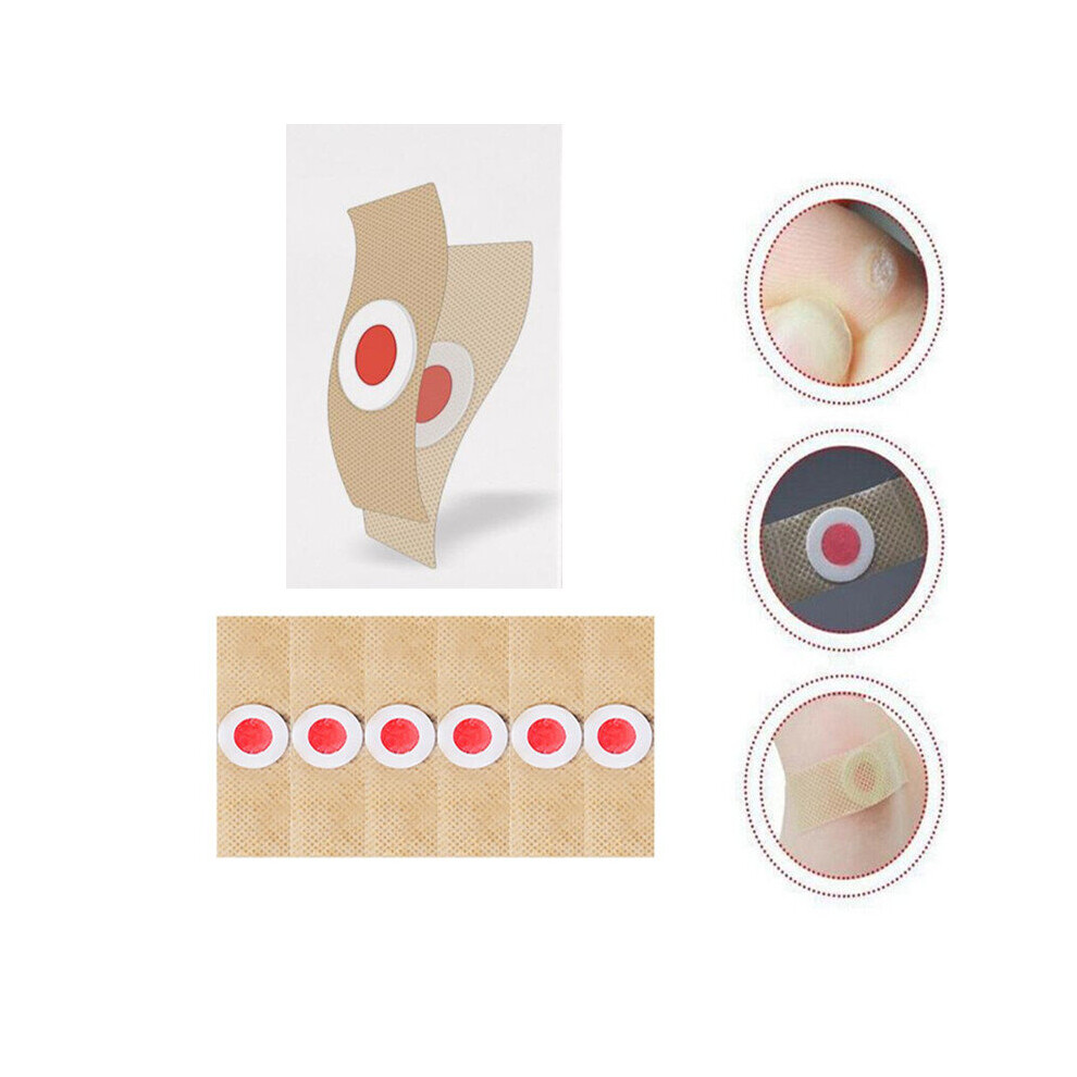 Wejoy 30/60Pcs Foot Care Sticker Medical Patch Corn Removal Pads Warts Thorn Curative Patches Calluses Remove Callosity Detox