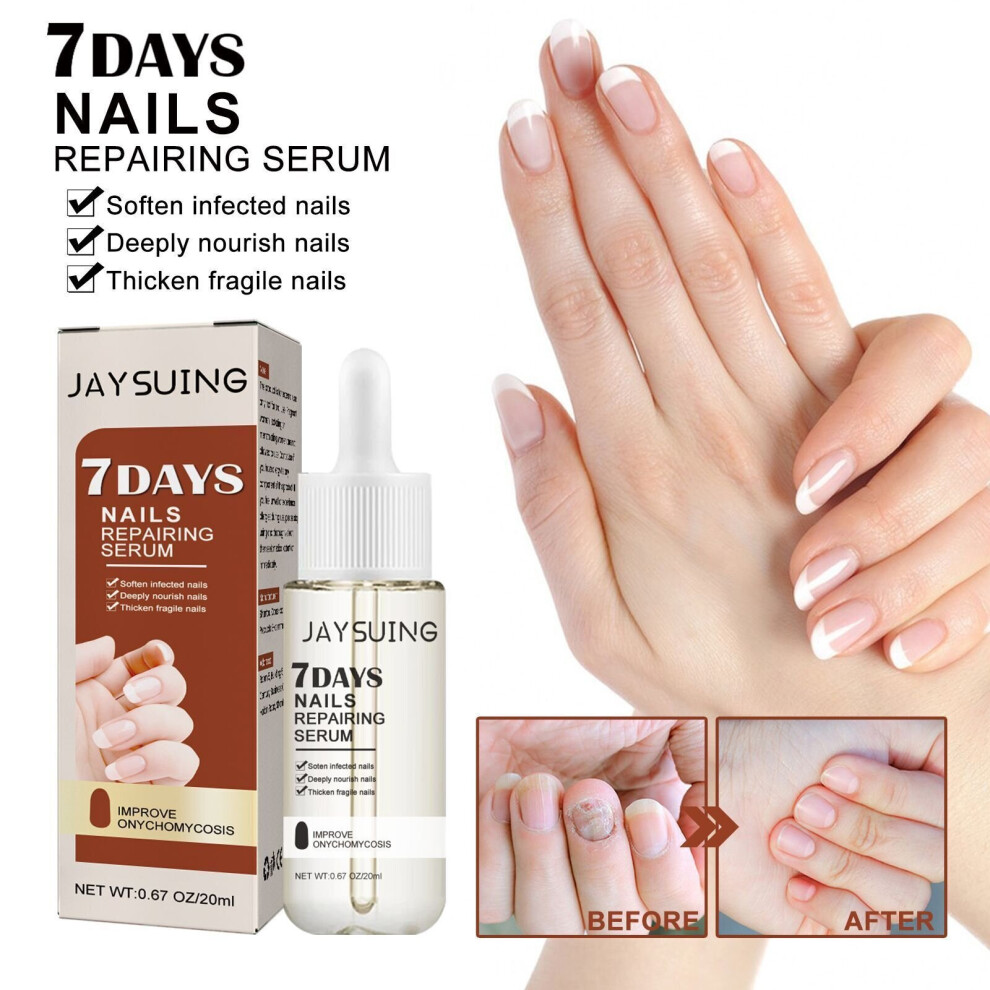 Skesrjtop 7 Days Nail Growth And Strengthening Serum, Nail Growth And Strength Serum