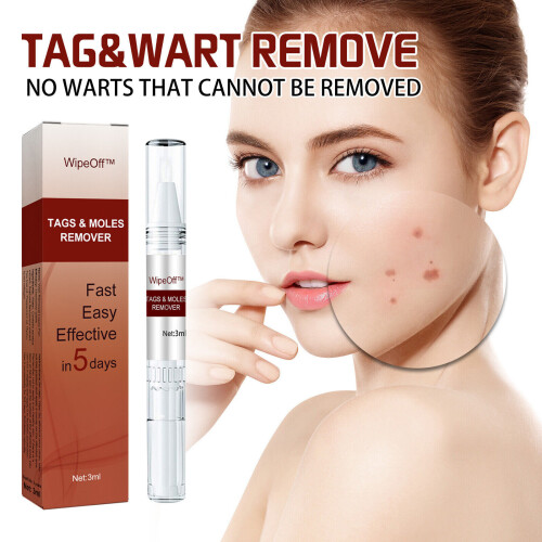 Wipeoff Tags & Moles Remover,Wipeoff Tags & Moles Remove,Quick & Safe Remove 1